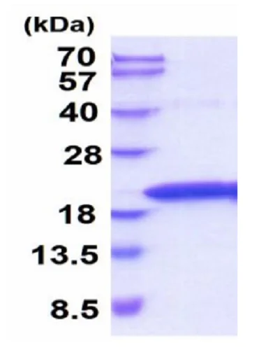 SDS-PAGE - Recombinant rat TNF alpha protein (Active) (AB229366)