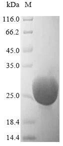 SDS-PAGE - Recombinant Rat Trypsin protein (AB240857)