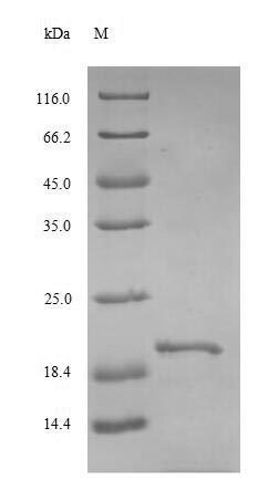 SDS-PAGE - Recombinant Rat TSH beta protein (Tagged) (AB237001)