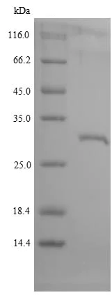 SDS-PAGE - Recombinant Rhesus monkey Growth hormone receptor protein (His tag) (AB235711)