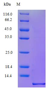 SDS-PAGE - Recombinant rhesus monkey IP10 protein (Active) (AB243264), expandable thumbnail
