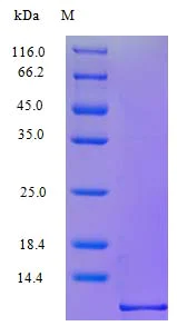 SDS-PAGE - Recombinant rhesus monkey IP10 protein (Active) (AB243264)