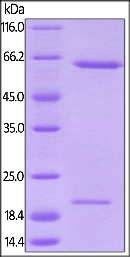 SDS-PAGE - Recombinant rhesus monkey PCSK9 protein (Active) (AB221401), expandable thumbnail