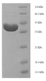 SDS-PAGE - Recombinant Ribosome inactivating protein alpha trichosanthin (Tagged) (AB236919), expandable thumbnail