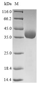 SDS-PAGE - Recombinant Rotavirus X VP4 protein (His tag) (AB238376), expandable thumbnail
