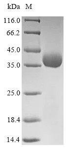 SDS-PAGE - Recombinant Rotavirus X VP4 protein (His tag) (AB238376)