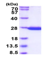 SDS-PAGE - Recombinant S. japonicum GST protein (Active) (Tag Free) (AB235135)