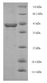 SDS-PAGE - Recombinant S. mansoni Major egg antigen protein (His tag) (AB224849), expandable thumbnail