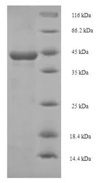 SDS-PAGE - Recombinant S. mansoni Major egg antigen protein (His tag) (AB224849)