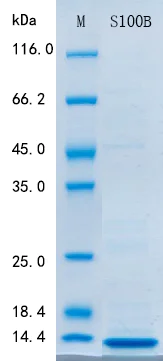 SDS-PAGE - Recombinant S100B Protein Standard (His tag) (AB316566)