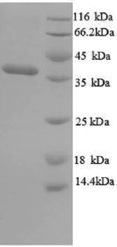 SDS-PAGE - Recombinant Salmonella typhi OmpA protein (His tag) (AB240774)