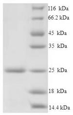 Recombinant Salmonella typhimurium PrgI protein (His tag)