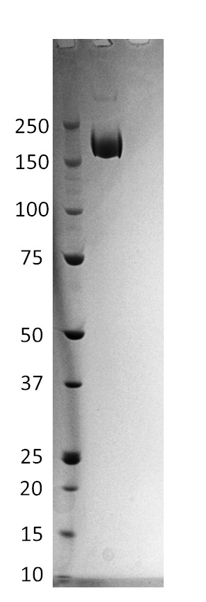 SDS-PAGE - Recombinant SARS-CoV-2 (B.1.1.28) stabilized spike glycoprotein (Tagged) (AB283530), expandable thumbnail