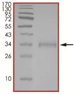 SDS-PAGE - Recombinant SARS-CoV-2 Spike Glycoprotein RBD (mutated K417T) (Active) (AB283525)