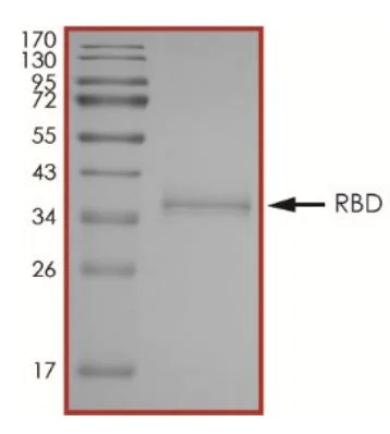 SDS-PAGE - Recombinant SARS-CoV-2 Spike Glycoprotein RBD (mutated S477N) (Active) (AB283528)