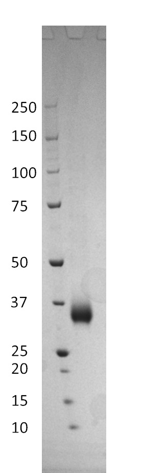 SDS-PAGE - Recombinant SARS-CoV-2 Spike (S1) RBD (mutated K417N + E484K + N501Y) protein (501Y.V2) (Tagged) (AB283531)