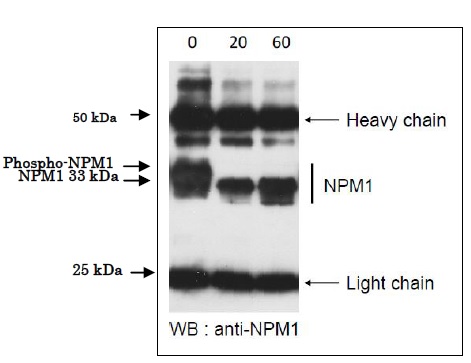 Immunoprecipitation - Recombinant Serine/threonine-protein phosphatase (AB188459)