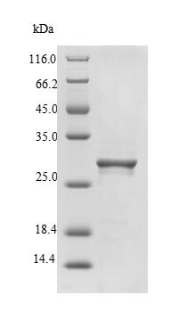 SDS-PAGE - Recombinant Snaclec rhodocytin subunit alpha protein (His tag) (AB225959)