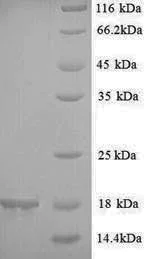 SDS-PAGE - Recombinant Soybean 2S albumin protein (His tag) (AB241227)