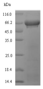 SDS-PAGE - Recombinant Soybean RUBISCO protein (Tagged) (AB236166)