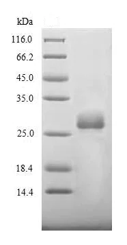 SDS-PAGE - Recombinant Spike glycoprotein (His tag) (AB235851)
