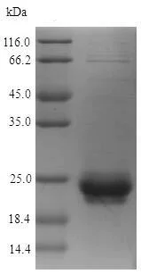SDS-PAGE - Recombinant Staphylococcus aureus 30 kDa neutral phosphatase protein (His tag) (AB224833)