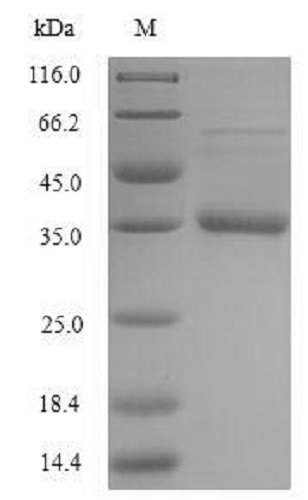 SDS-PAGE - Recombinant Staphylococcus aureus Acyl carrier protein (Tagged) (AB235813)