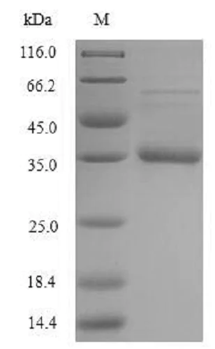 SDS-PAGE - Recombinant Staphylococcus aureus Acyl carrier protein (Tagged) (AB235813)