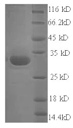 SDS-PAGE - Recombinant Staphylococcus aureus Exfoliative Toxin A/ETA protein (His tag) (AB236933)