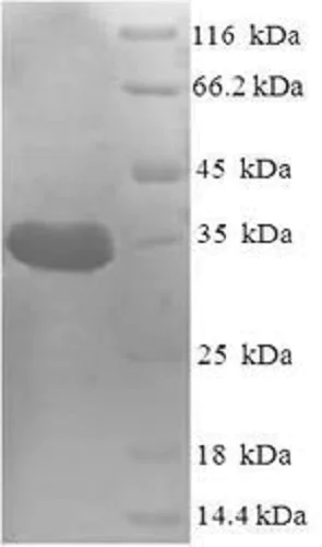 SDS-PAGE - Recombinant Staphylococcus aureus PDF protein (Tagged) (AB235870)