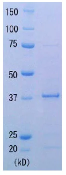 SDS-PAGE - Recombinant thermus aquaticus RecA protein (AB123228)