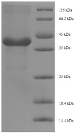 Recombinant Tobacco Osmotin protein (His tag)