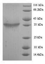 SDS-PAGE - Recombinant Toxin zeta protein (His tag) (AB238386), expandable thumbnail