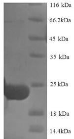 SDS-PAGE - Recombinant Trypsin inhibitor DE-3 protein (His tag) (AB238363)