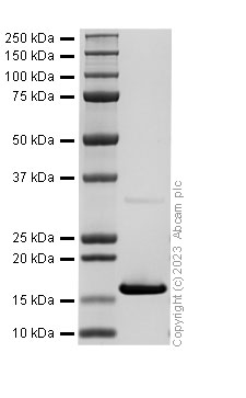 SDS-PAGE - Recombinant TTR Protein (His tag) (AB313360), expandable thumbnail