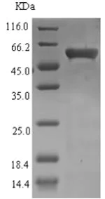 SDS-PAGE - Recombinant UVSX protein (Tagged) (AB237746)