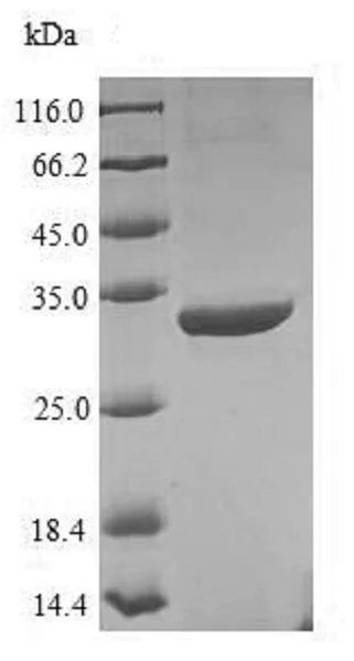 SDS-PAGE - Recombinant uvsY protein (His tag) (AB225610)