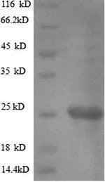 SDS-PAGE - Recombinant vacA protein (His tag) (AB225655)