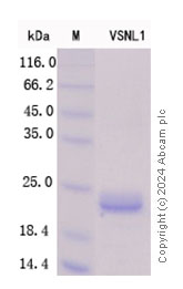 SDS-PAGE - Recombinant VILIP1 Protein Standard (His tag) (AB316535), expandable thumbnail
