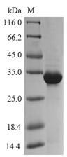 SDS-PAGE - Recombinant Wheat Trypsin/alpha-amylase inhibitor CMx1/CMx3 protein (Tagged) (AB238371)