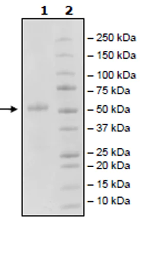 SDS-PAGE - Recombinant Woodchuck CTLA4 protein (Tagged) (AB271482)