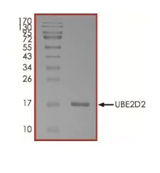 SDS-PAGE - Recombinant X. laevis UBC4 protein (Active) (AB269097)