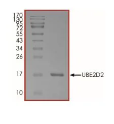 SDS-PAGE - Recombinant X. laevis UBC4 protein (Active) (His tag N-Terminus) (AB269097)