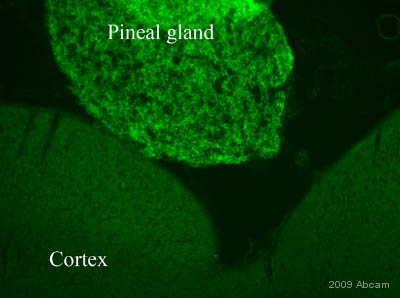 Immunohistochemistry (PFA perfusion fixed frozen sections) - Anti-Recoverin antibody [6A55CD6] (AB31928)