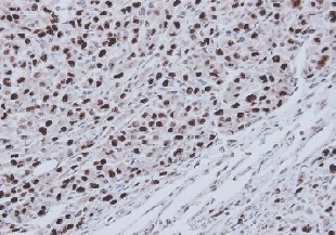 Immunohistochemistry (Formalin/PFA-fixed paraffin-embedded sections) - Anti-RECQ1 antibody (AB151501)