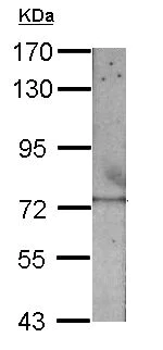 Western blot - Anti-RECQ1 antibody (AB151501)