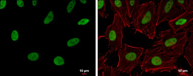 Immunocytochemistry/ Immunofluorescence - Anti-RECQ1 antibody (AB272855)