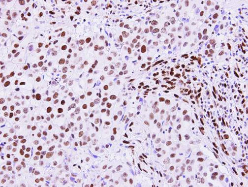 Immunohistochemistry (Formalin/PFA-fixed paraffin-embedded sections) - Anti-RECQ1 antibody (AB272855)