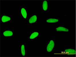 Immunocytochemistry/ Immunofluorescence - Anti-RECQ1 antibody (AB89817), expandable thumbnail
