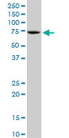 Western blot - Anti-RECQ1 antibody (AB89817), expandable thumbnail